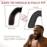 Level 2 Sports Mouthguard